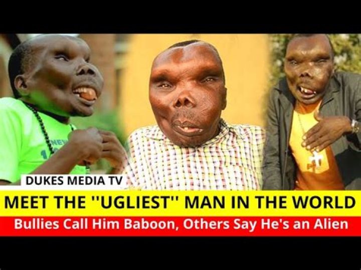 Exploring The World's Most Ugliest Man